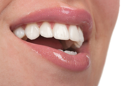 Porcelain Veneers