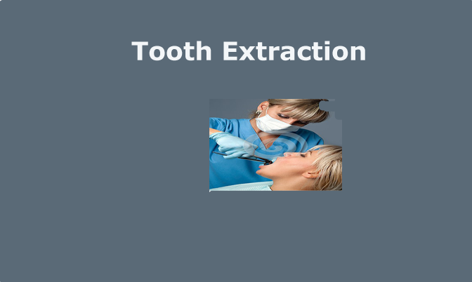 Tooth Extraction